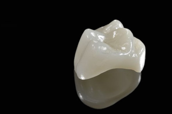 Are CEREC® Crowns Safe? Understanding Restorative Dental Materials