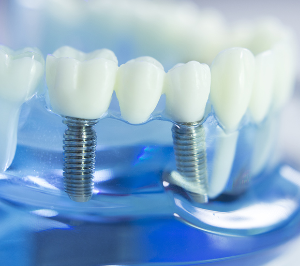 West Grove Dental Implants