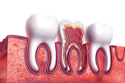 A Root Canal Dentist In West Grove: Explaining The Basics Of A Root Canal