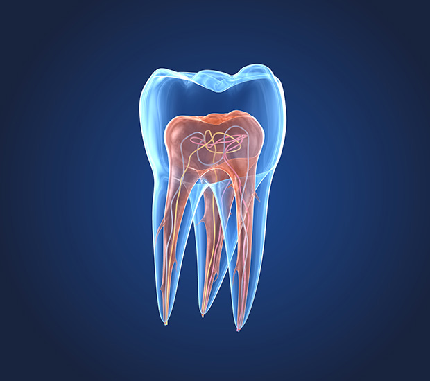 West Grove What is an Endodontist